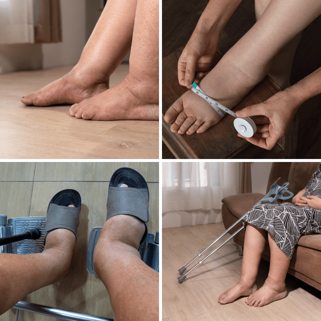 OrthoMax® Thérapie Lymphatique - Vela Vici 🇫🇷